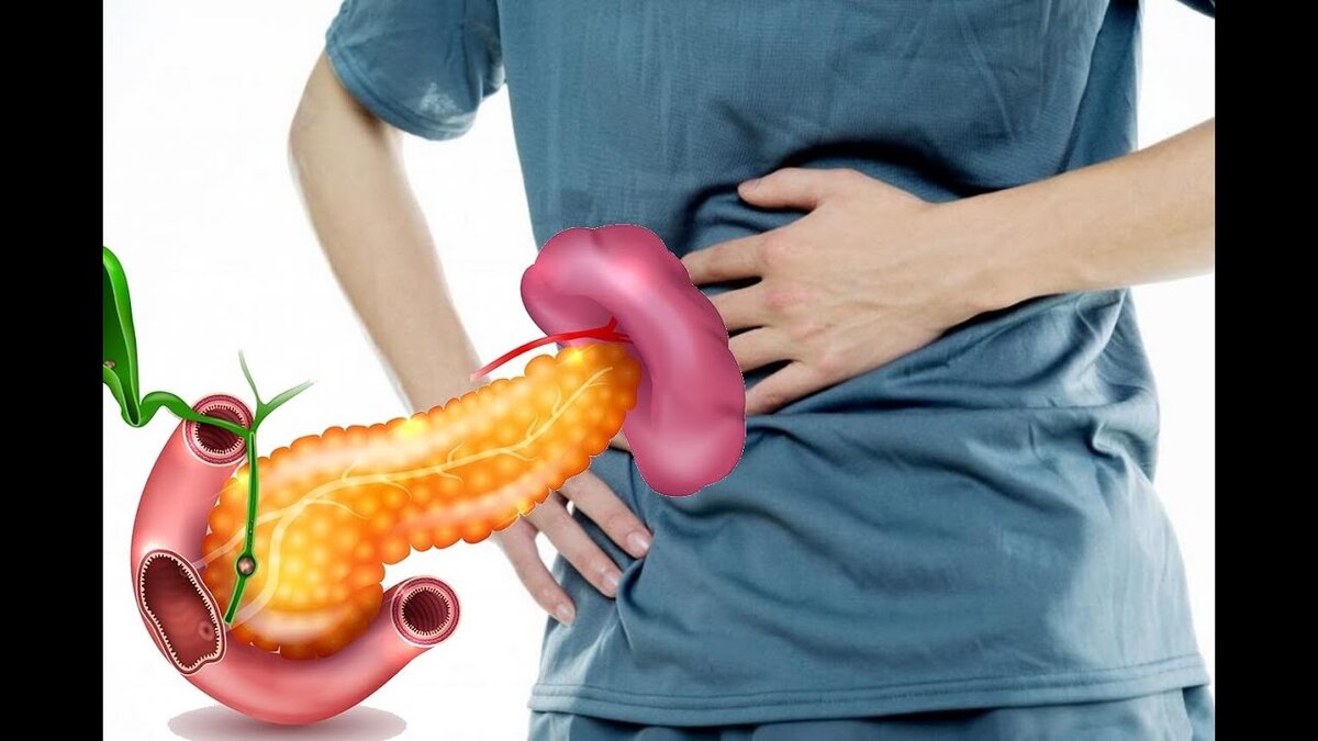 Какие сигналы посылает организм при появлении острого и хронического панкреатита, рассказал гастроэнтеролог Владивостока