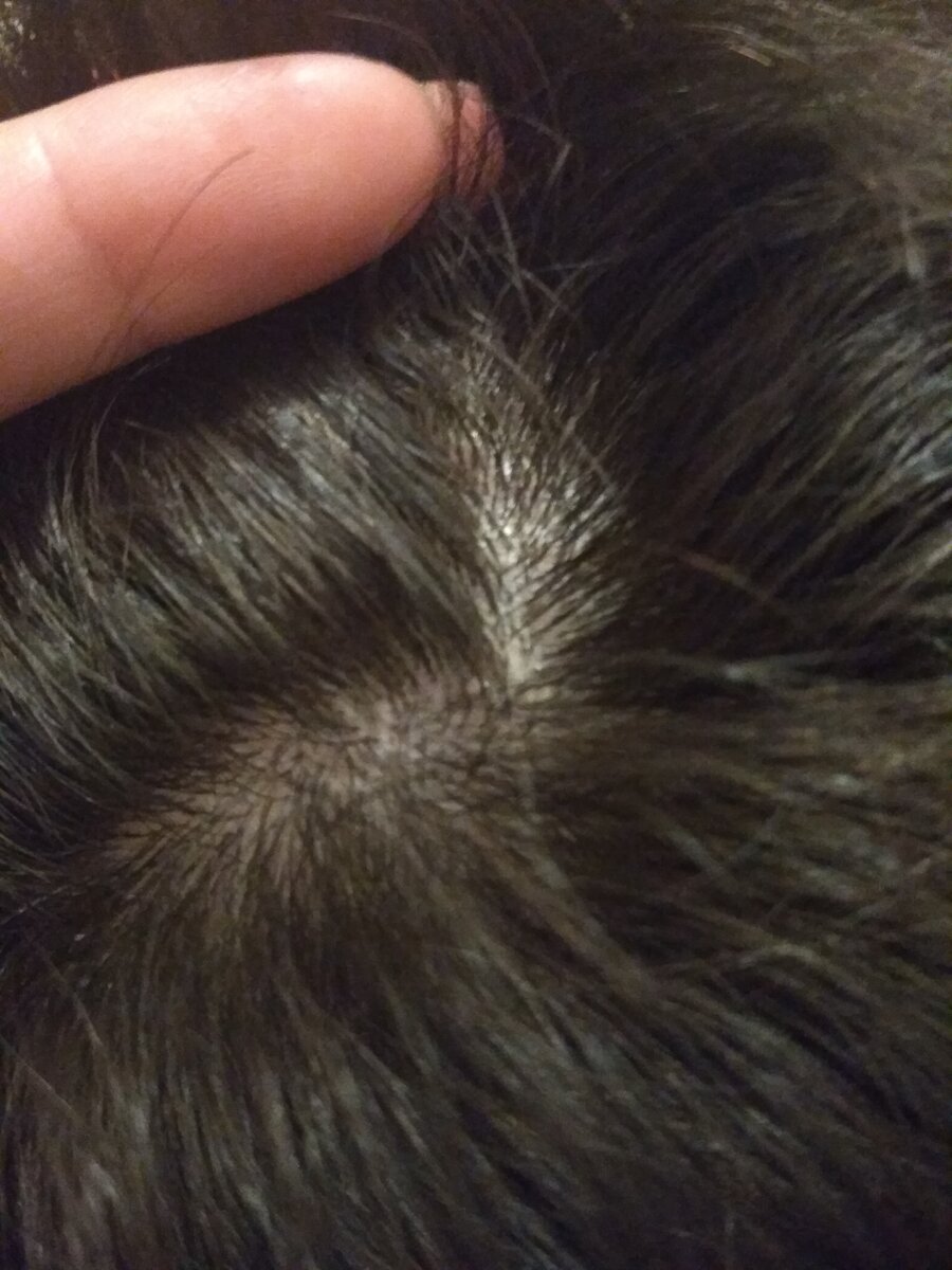  К сожалению, нет фото ДО, так как результата мы не ждали и не собирались писать этот отзыв Фото от Tati