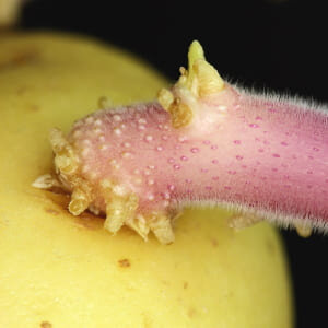 Паразитолог: "Если на груди, шее или на подмышках папилломы, срочно перестаньте...
Читать далее