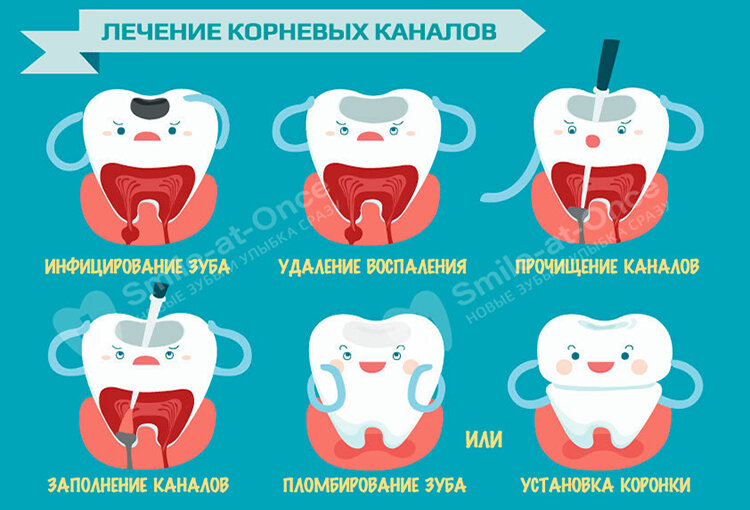 Стоматолог-терапевт: что делает этот врач, и как он лечит