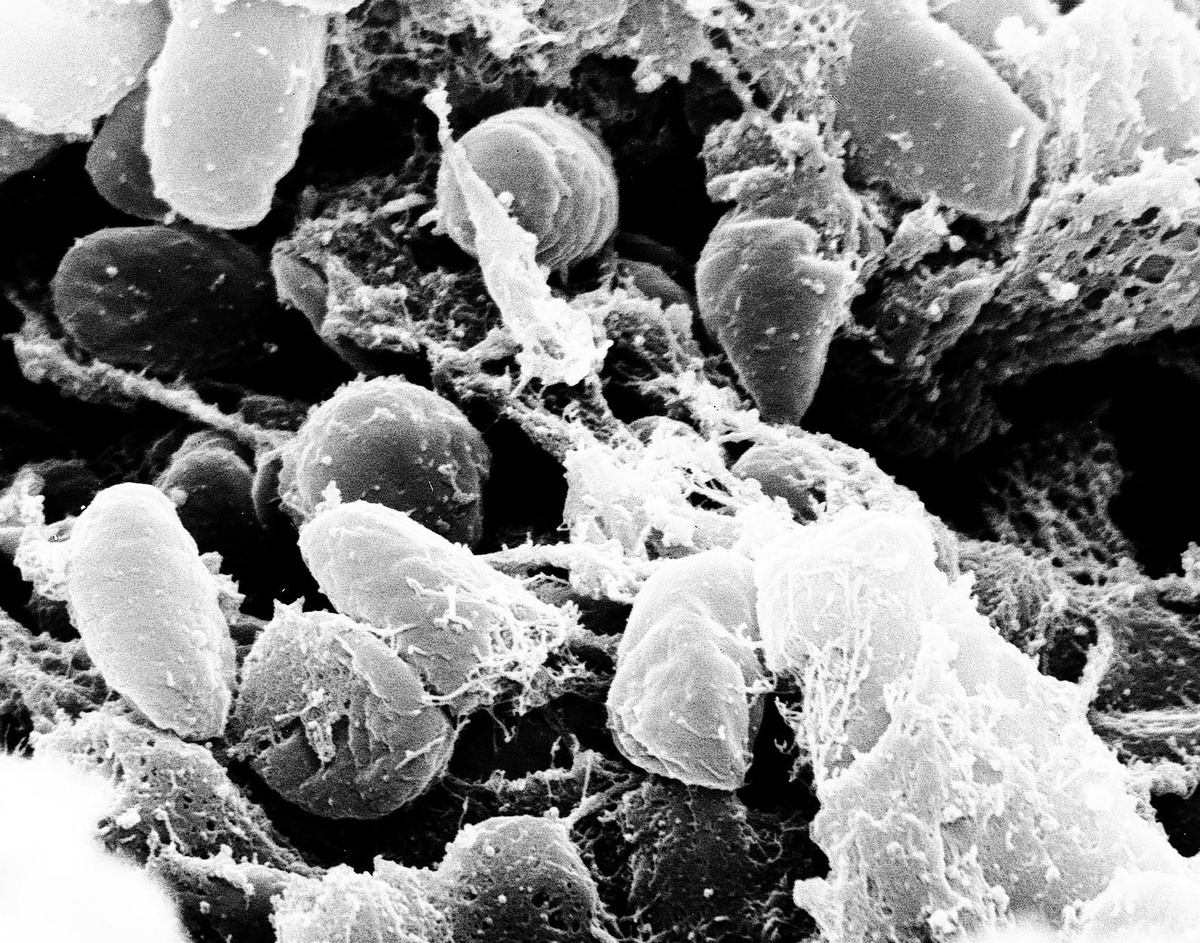 Чумная палочка (лат. Yersinia pestis) - смертоносный вирус,  о котором существуют упоминания с Библейских времен. 