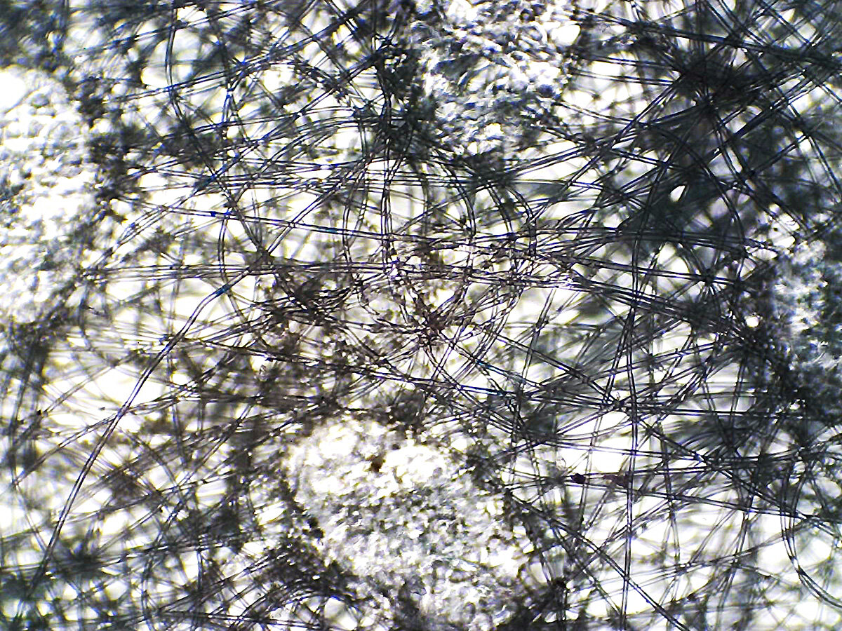 Маска под микроскопом и коронавирус. Маска под микроскопом. Волокна маски и коронавирус под микроскопом. Маска и ковид под микроскопом. Медицинская маска под микроскопом.