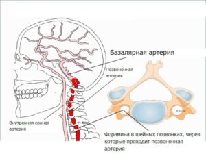 Аневризмы сосудов головного мозга