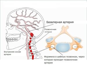 Гипоплазия артерии головного мозга имеет врождённую, реже приобретённую природу происхождения. В первом случае узкий артериальный просвет является следствием интоксикации женщины во время беременности. Курение и алкоголь, инфекционные заболевания (краснуха, грипп), приём лекарств и токсичные отравления, а также стрессы и депрессии приводят к неправильной закладке позвоночных сосудов. Признаки гипоплазии правой позвоночной артерии нередко наблюдаются у малыша после того, как в утробе пуповина обмотается вокруг шеи, даже если проблема вовремя устраняется. У эмбриона и новорожденного диагностировать патологию невозможно, она проявляется во взрослом возрасте, чаще на фоне других сердечно-сосудистых заболеваний.