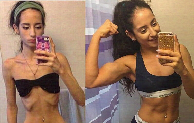 На фото, конечно, девушка была уже худая, но суть должна быть понятна. 
(фото из интернета)