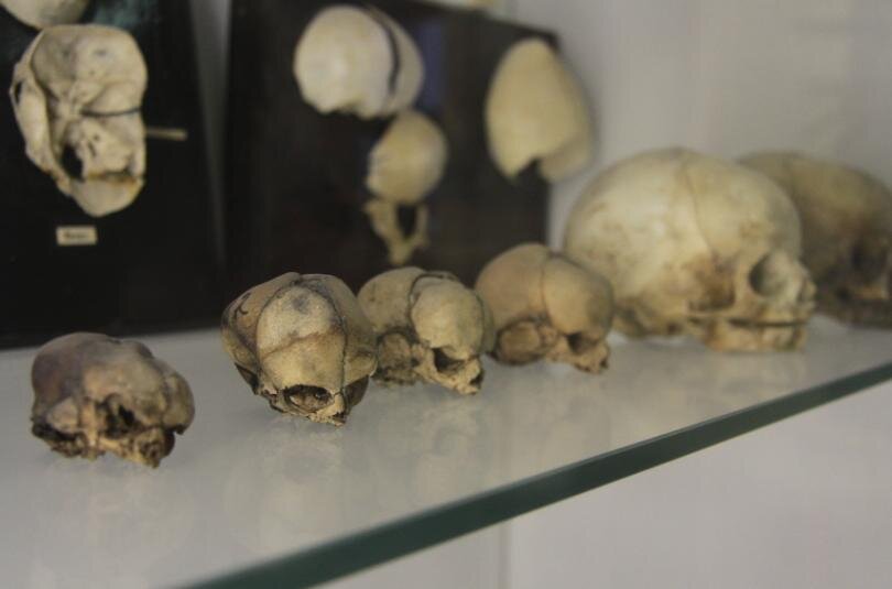 Анатомический музей-театр