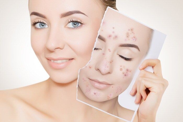 Советы от дерматолога!