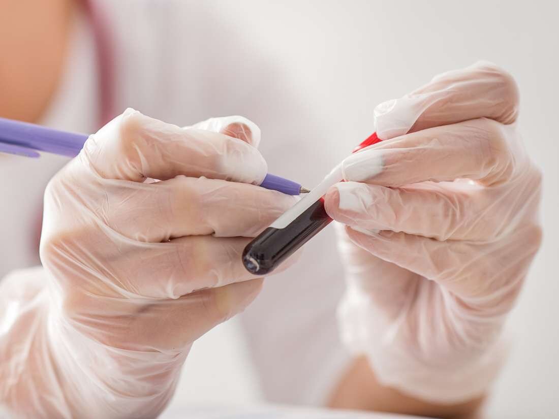 Забор крови из вены для чего делается