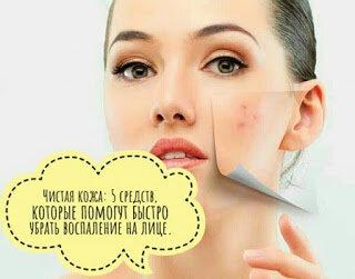 Чистая кожа: 5 средств, которые помогут быстро убрать воспаление на лице