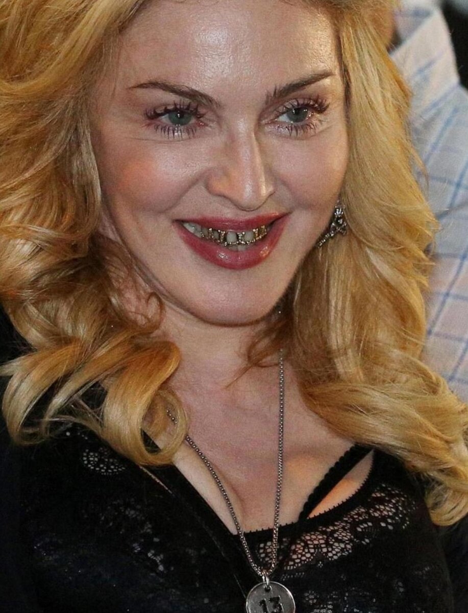 Мадонна носит грилзы в виде золотых решёток , украшенных бриллиантами  