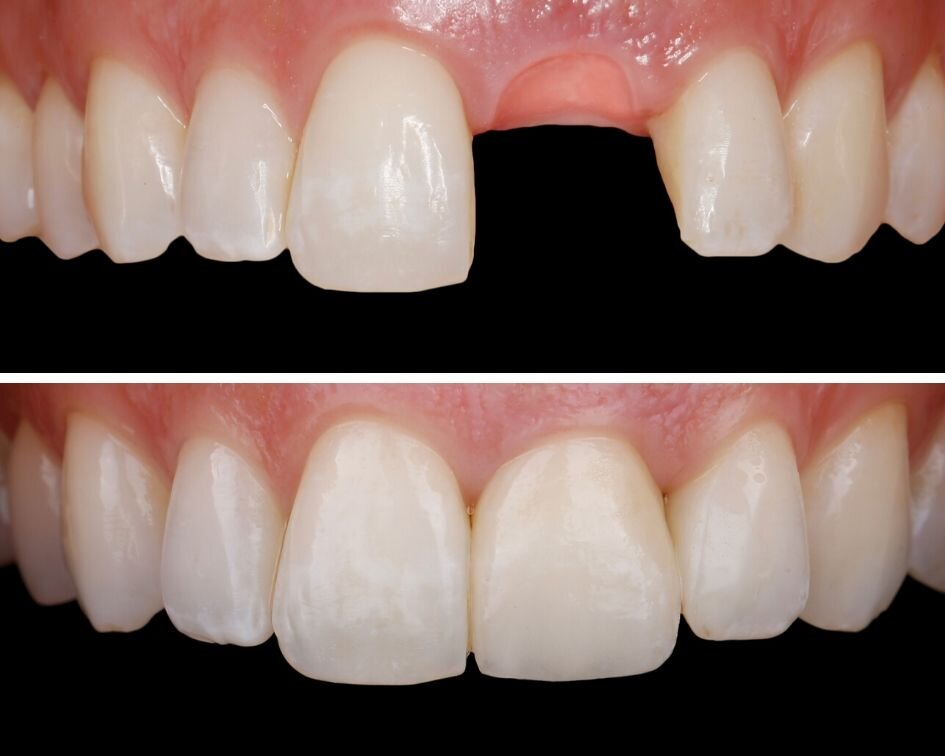 Фото ©Richard Varadappa, ©Johanna Ringler