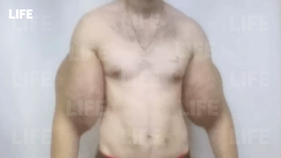 Life«Мы очень часто слышим из разных источников, что якобы Кирилл вводил себе синтол. На самом деле... он вводил себе вазелин, причем делал это очень быстро», - заявил он.