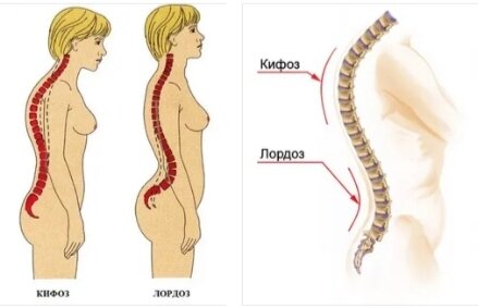 Боль в пояснице и нижних конечностях