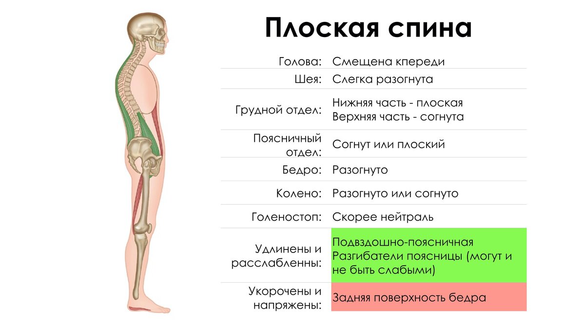 Картинки плоская спина