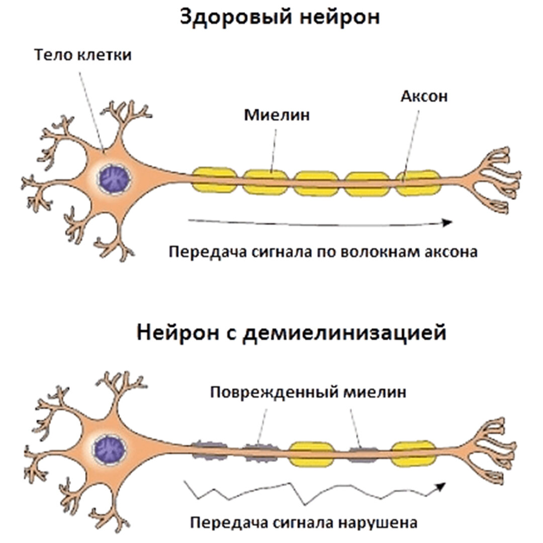 Схема регенерации нейрона