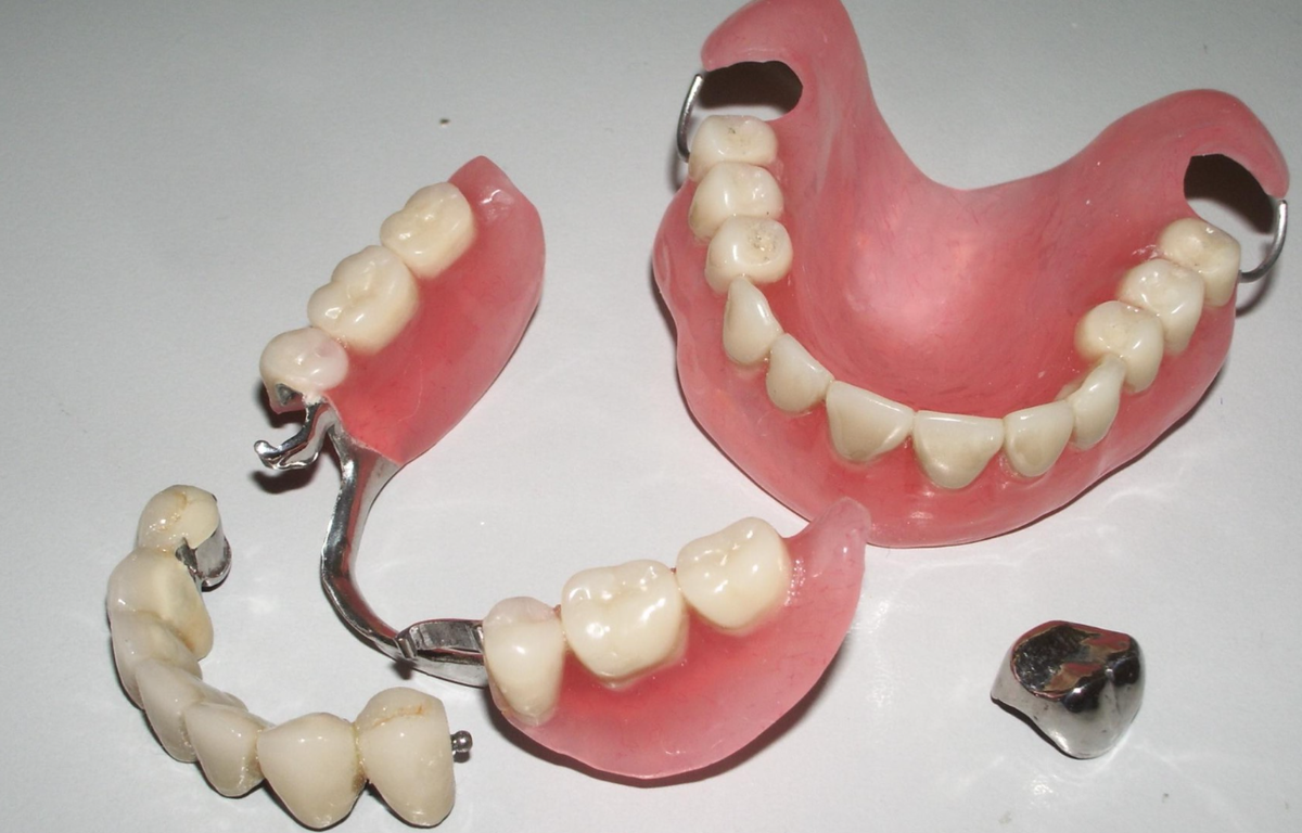 Нижний протез зубов какой. Съемный бюгельный протез. Съемный бюгельный протез (1 челюсть). Полносъемные протезы ортопедическая стоматология. Бюгельный протез зубов.