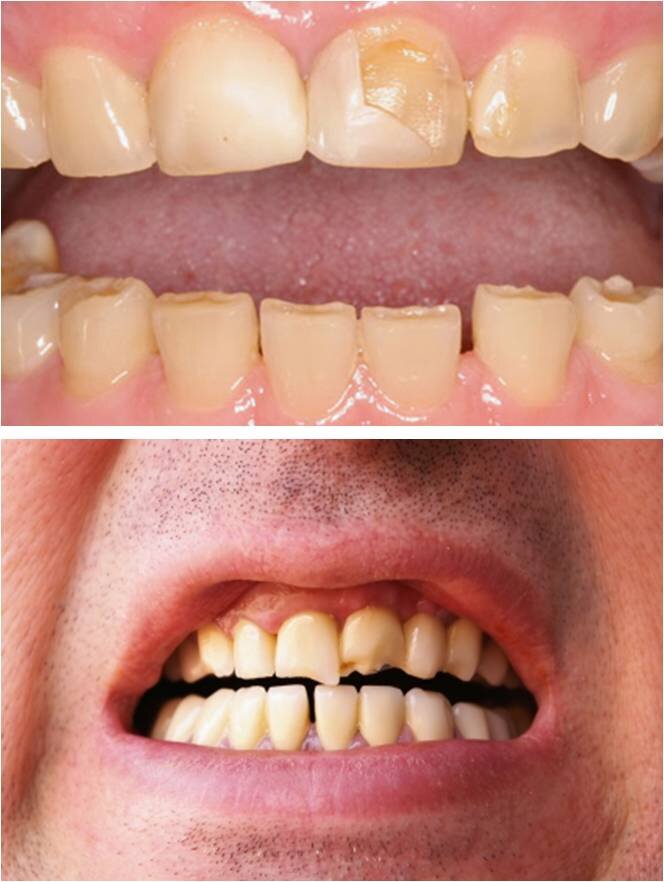 Последствия