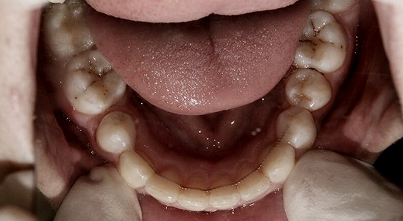 Несъемную конструкцию практически невозможно разглядеть 