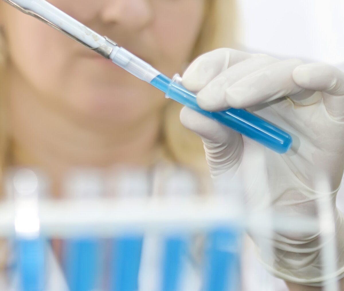 Сдайте комплексный анализ крови в медицинском центре «Мир здоровья» в Санкт-Петербурге по акции!