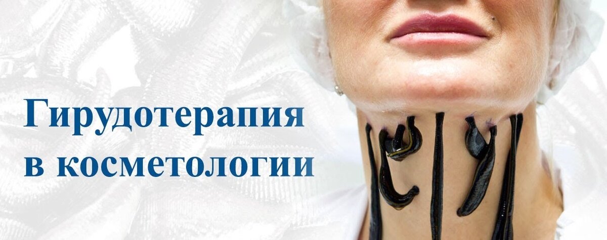 Гирудотерапия картинки реклама