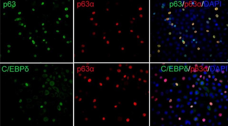     Клетки из биоптата лимба экспрессируют маркеры стволовых клеток Ula V. Jurkunas et al. / Science Advances, 2023