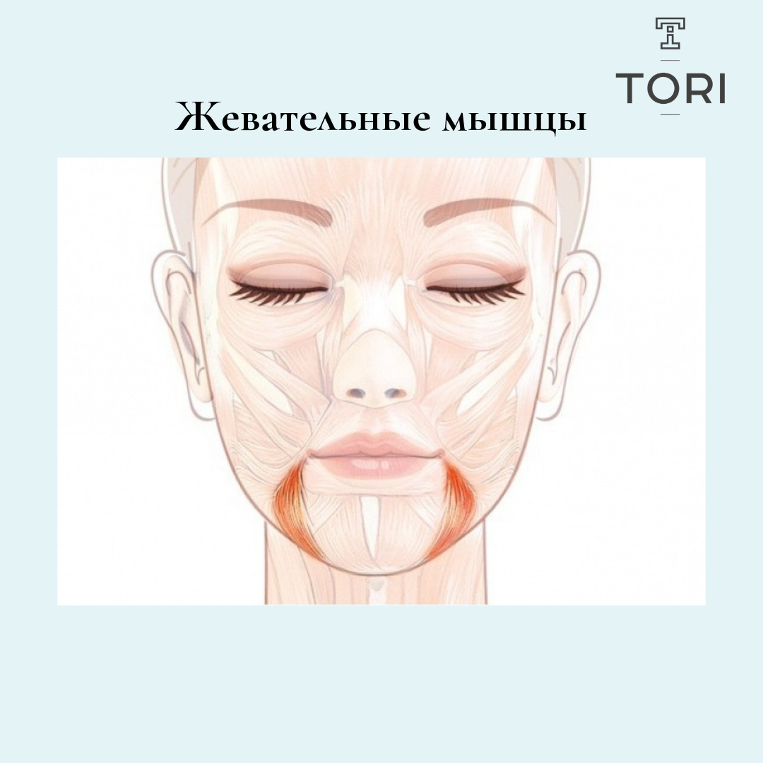 Ботокс в жевательные мышцы схема