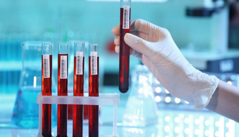 Тест на карбогидрат-дефицитный трансферрин