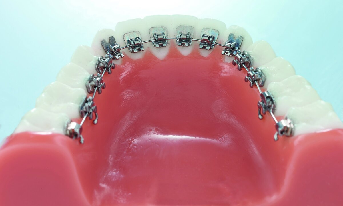 Фото взято из открытого источника