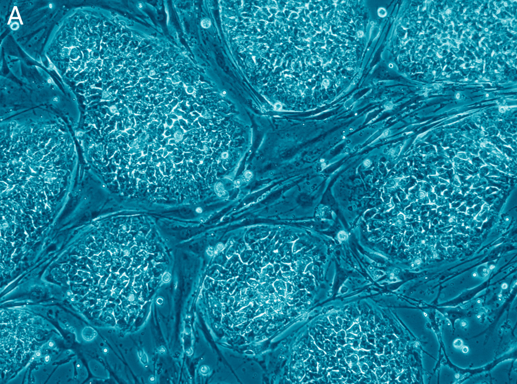 https://upload.wikimedia.org/wikipedia/commons/5/50/Human_embryonic_stem_cells_only_A.png