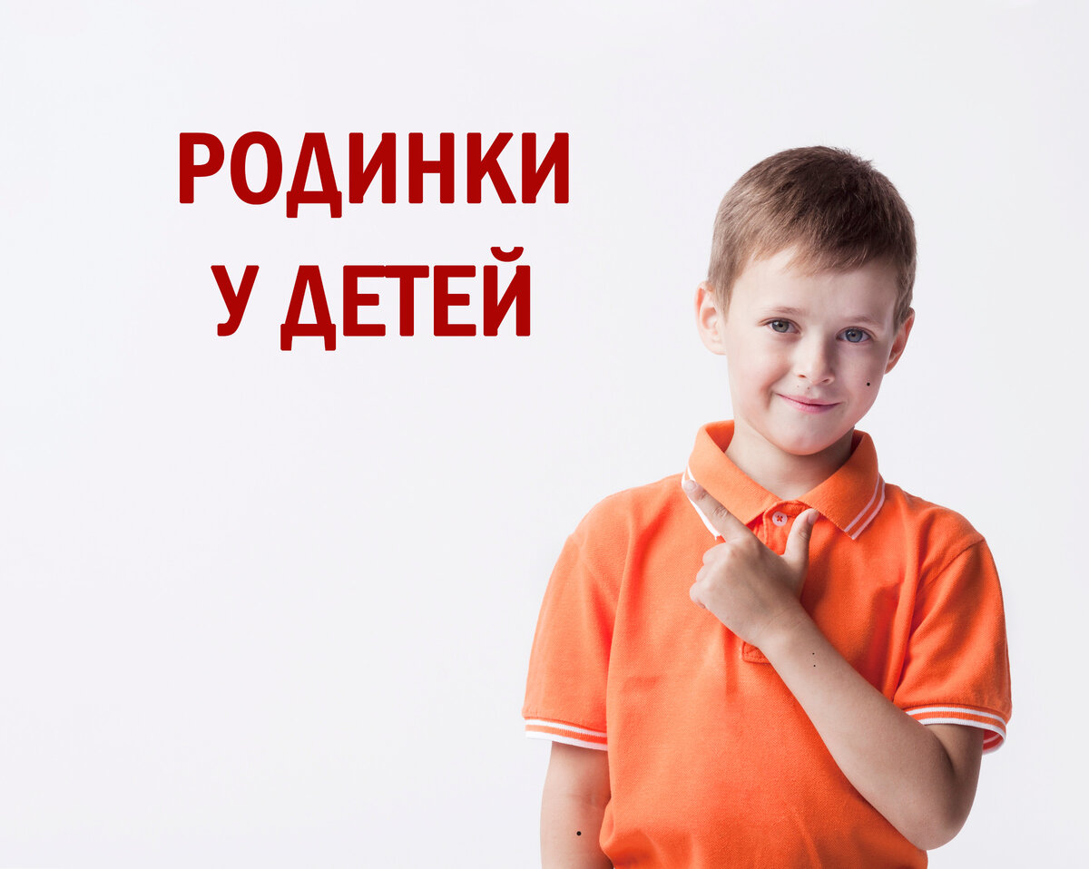 Родинки у детей
