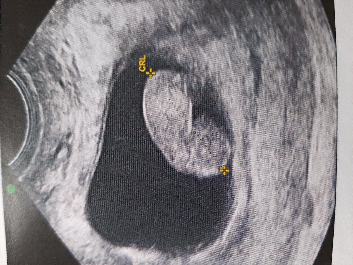 Смотрите-какой красавчик!) Фото любезно предоставлено кафедрой лучевой диагностики