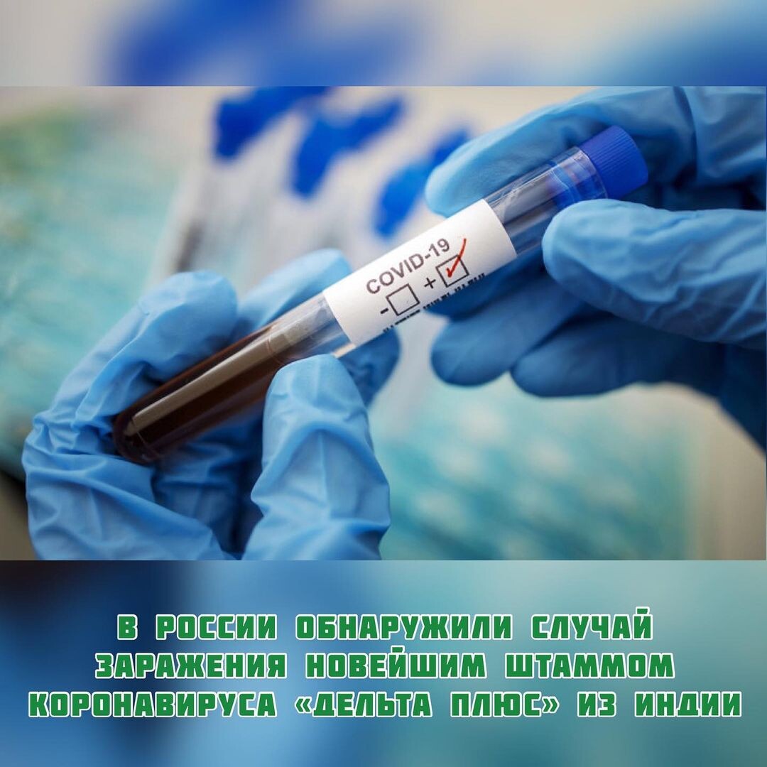 В России нашли первый случай заражения новейшим штаммом коронавируса «Дельта плюс», который был обнаружен в июне этого года. Об этом пишет РИА Новости.

По словам замдиректора НИИ гриппа имени Смородинцева Дарьи Даниленко, был зафиксирован единственный и, скорее всего, завозной, случай коронавируса. Такие же факты заражения были обнаружены в США, Великобритании и других странах.

Напомним, в центральной части Индии было выявлено 20 новых случаев заражения новым штаммом коронавируса, однако, минздрав страны посчитал, что новая мутация не вызывает опасений.

Источник: prufy.ru @prufy.ru 

#ufa_rb_02_official #ufa #bashkortostan #covid_19 #индия #дельтаплюс