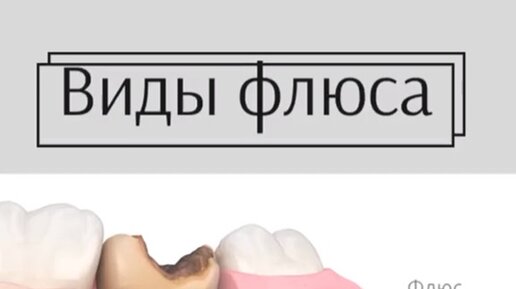 Ваш Стоматолог🦷 | флюс#удалениезуба #пульпит #переодонтит | Дзен