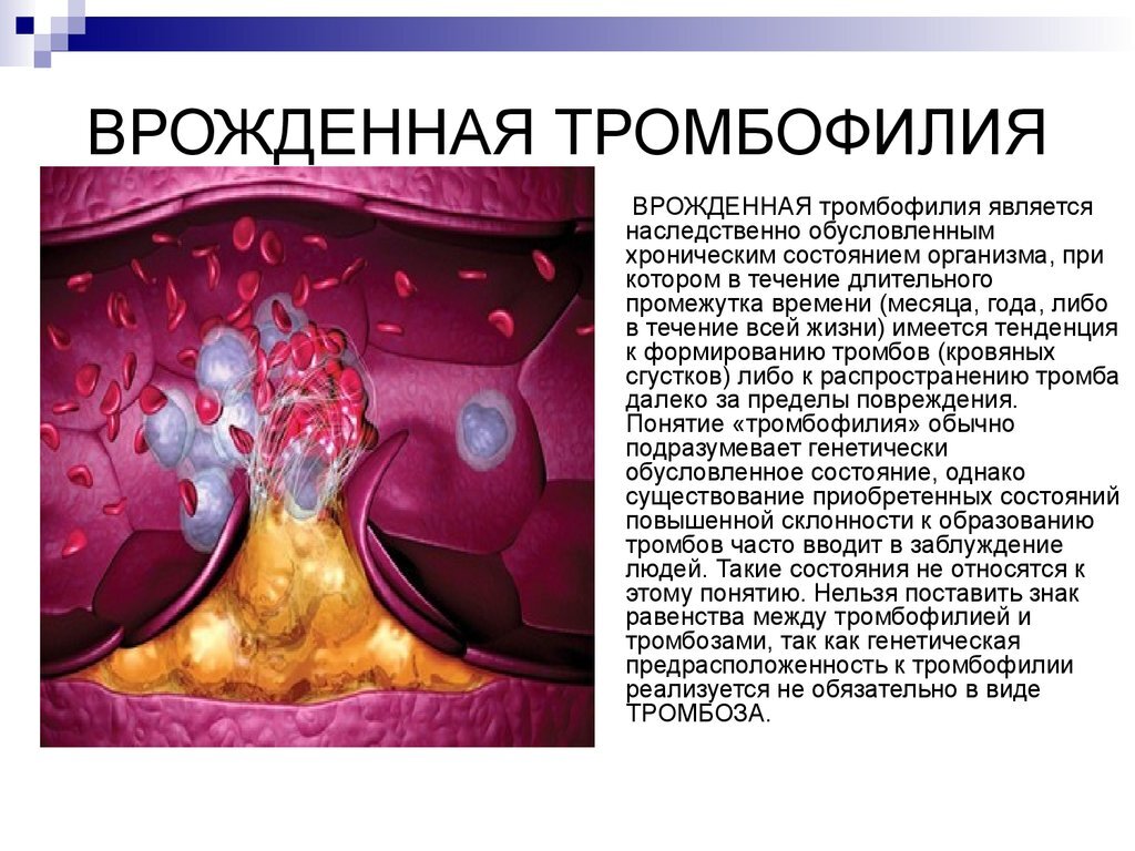 Исследования на мутации генов гемостаза, фолатного цикла