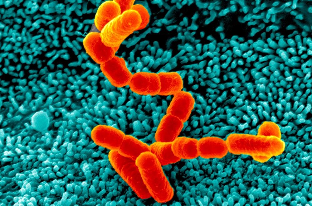 Шигелла - бактерия содержание которой в воде может вызвать острый шигеллез (дизентерию) 