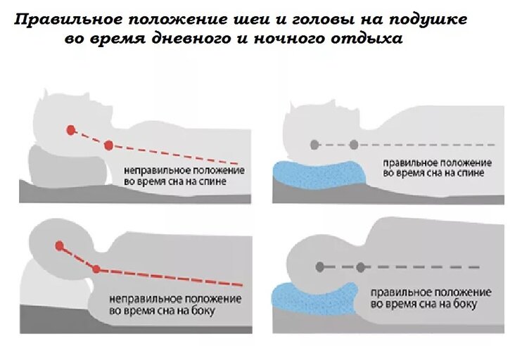 Почему болит Шея и что делать при болях в шее