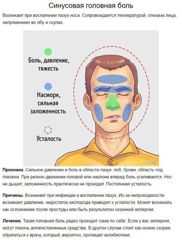 Давление болит в висках. Типы головной боли. Болит голова. Типы головной боли и причины.