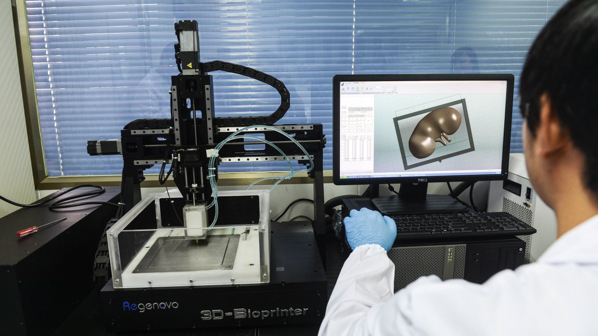 Создание модели органа на компьютере