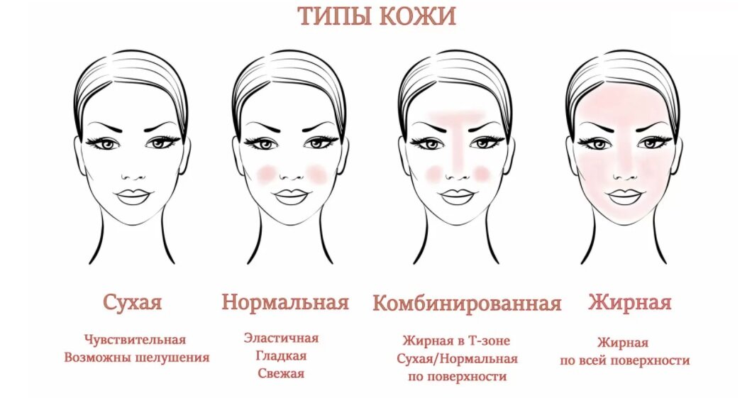 Классически в косметологии выделяют 4 типа кожи: жирная, сухая , нормальная и комбинированная, в свою очередь комбинированная бывает склонная к жирности или к сухости. Знание своего типа кожи, очень важно, для того , чтобы правильно подобрать уход и закрыть потребности Вашей кожи. Как правило , понимание жирная или сухая кожа не вызывает вопросов, важно понимание- жирная кожа, та у которой повышена выработка кожного сала, а сухая, та, у которой, кожного сала недостаточно. Визуально жирная кожа, тусклая, плотная, могут быть расширенные поры и черные точки, жирный блеск. Сухая кожа, наоборот, очень тонкая, нежная, поры очень маленькие, присутствует стянутость, может быть шелушение.Есть тест для определение типа кожи с помощью салфетки в домашних условиях. Умыться со своим привычным очищающим средством, ни чего на кожу больше не наносить,через два часа после умывания промокнуть лицо сухой бумажной салфеткой и оценить результат. Если на салфетке присутствуют жирные пятна, ярко выраженные -ваша кожа, жирная, умеренные -нормальная, пятна отсутствуют- сухая. А еще есть такие понятия, как кожа обезвоженная и кожа чувствительная, так вот, это уже не типы кожи, этот состояние кожи и обезвоженной может быть как жирная, так и сухая кожа. Как я уже писала, сухая, это та кожа, у которой недостаточно кожного сала, а обезвоженная, это та, которой, не достаточно увлажнения. Понимание этого, говорит о том, что подход к коррекции состояния разные. Об этом поговорим в следующей публикации.                                                                                                         #жирнаякожа #типыкожи #сухаякожа #типыкожиопределить #чувствительнаякожа #косметологкраснодар 
