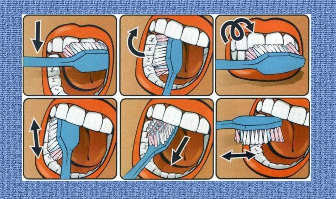 Когда лучше чистить зубы. Схема правильной чистки зубов. Правельна схема чистки зубов. Как правильно чистить зубы. Алгоритм чистки зубов для детей.