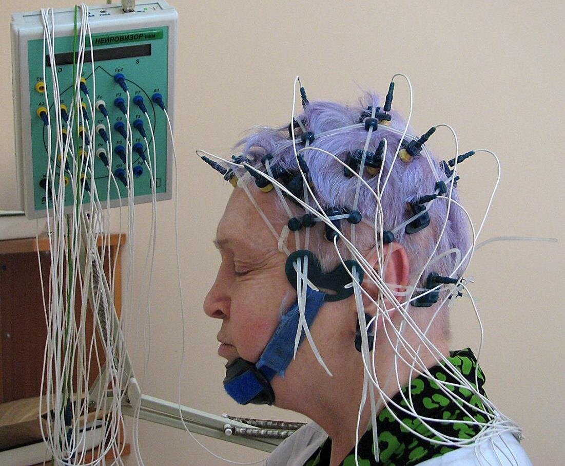 Ээг работа. ЭЭГ РЭГ Эхо. Электроэнцефалография головного мозга (ЭЭГ). РЭГ И ЭЭГ. ЭЭГ И Эхо ЭГ что это.