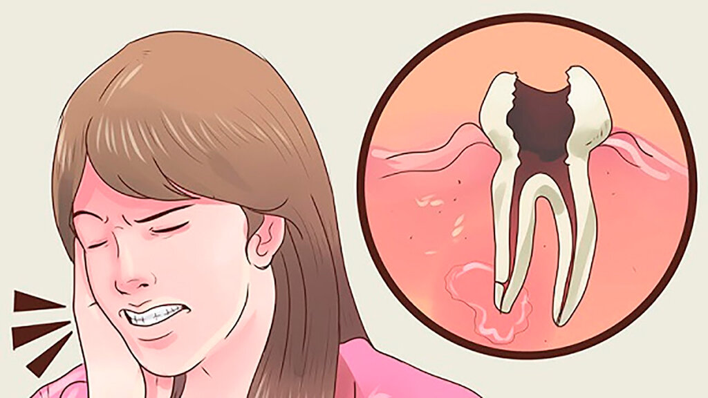 Зубная боль – как избавиться быстро в домашних условиях