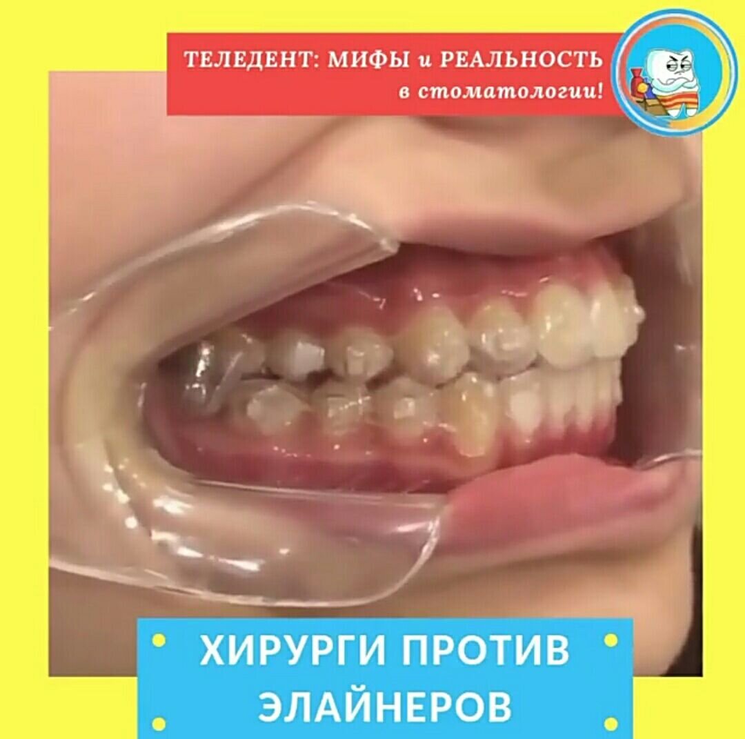 👇Смотрите видео ниже👇