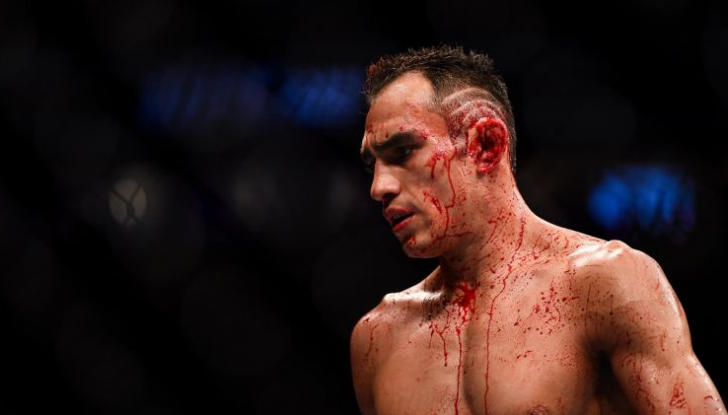 Тони Фергюсон, которого я взял из интернета.