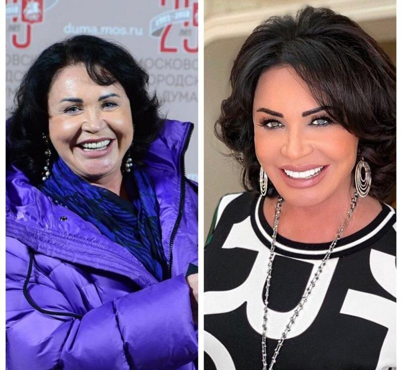 24smi.org Народная артистка ДО / ПОСЛЕ похудения