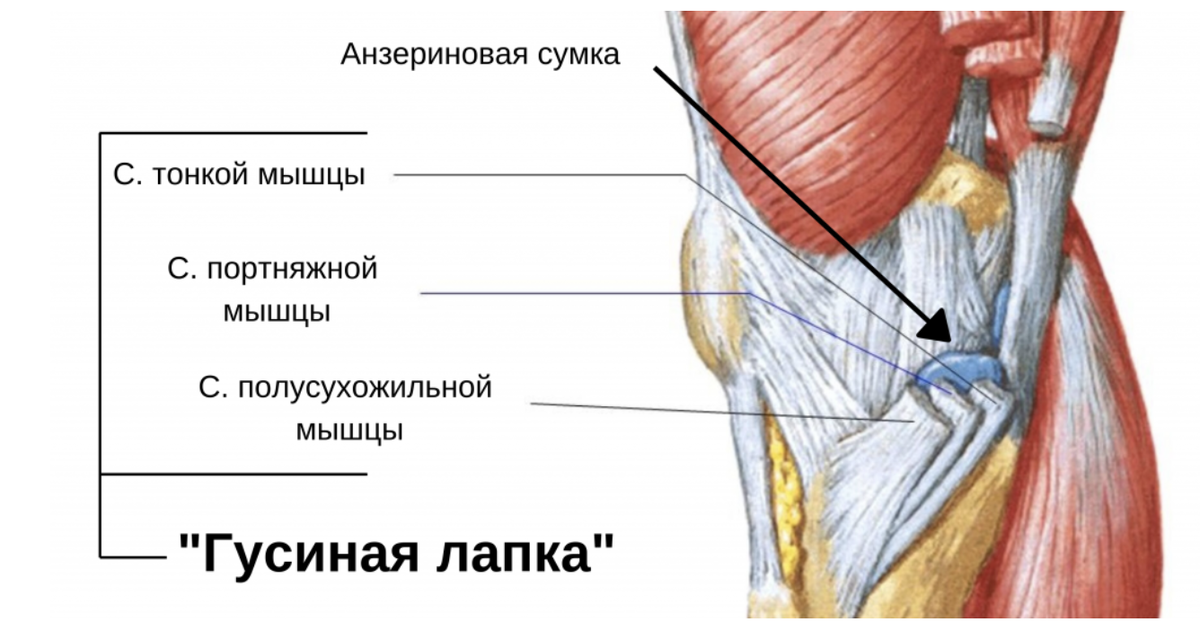 Где болят связки. Гусиная лапка сухожилия коленного сустава. Сухожилия гусиной лапки анатомия. Сухожилие гусиной лапки коленного сустава. Бурсит сухожилий гусиной лапки.