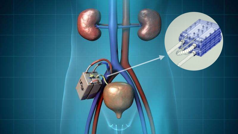 Источник Kidney Project 