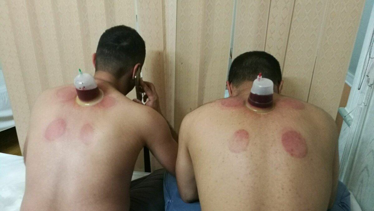     Имамы и другие представители исламского духовенства не поддерживают лечение у знахарей и подобных им целителей, так как они общаются со злыми духами, об этом рассказал собеседник NewsTracker.