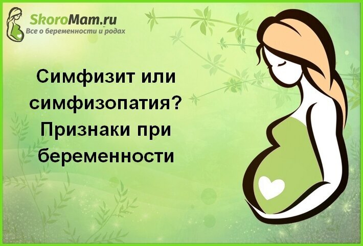 Симфизит расхождение лонного сочленения. Симптомы симфизита. Симптомы симфизита. Симфизит при беременности симптомы. Где болит при симфизите у беременных.