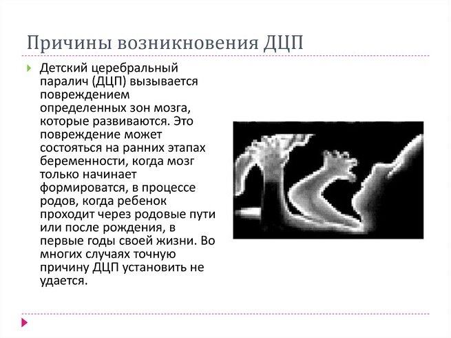 
Причины развития болезни разделяют на несколько групп